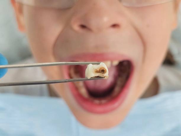 Best Emergency Pediatric Dentist  in Pine Level, AL